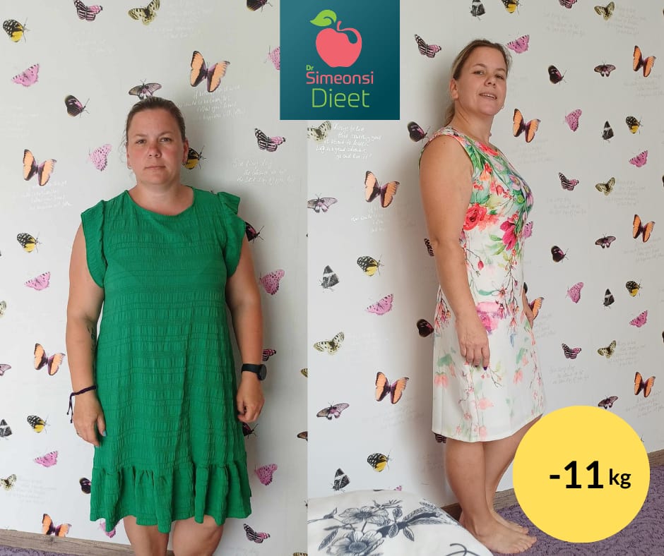 11,2 kg kaotanud Annely kogemus näitab, kuidas paranes tema enesetunde ja tervise kvaliteet.